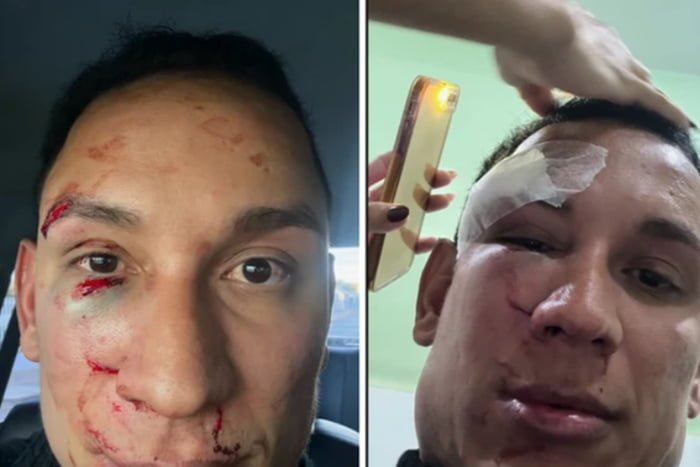 Dentista sofre agressão violenta em camarote na Bahia