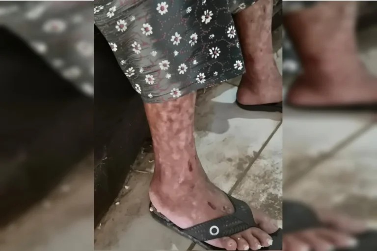 Filho mantinha mãe idosa presa e dizia palavras cruéis