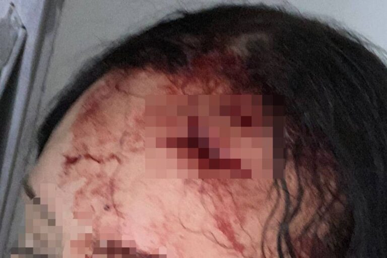 Homem agride mulher com garrafa após rejeição no DF