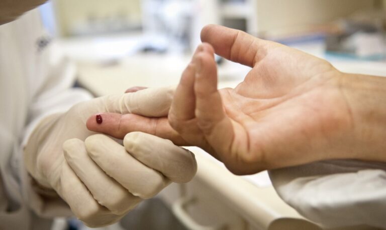 Idade biológica de quem tem HIV pode ser até 13 anos maior, diz estudo