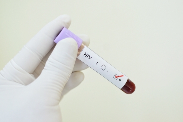 HIV Cresce Rápido em Fiji: Entenda o Motivo